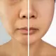 Kremas reguliuojantis veido odos sebumo išsiskyrimą